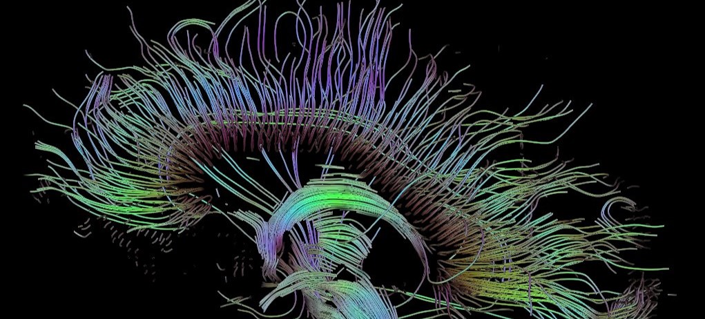 Stout-Neuropsych